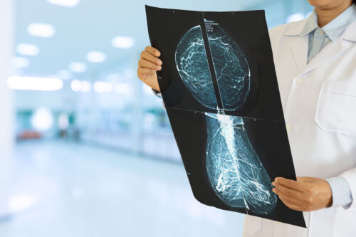 Obgyn doctor in Idaho Falls examining mamagram.